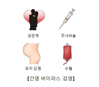 B형 간염 증상·원인·치료