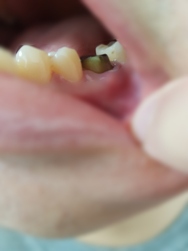 메탈포스트기둥