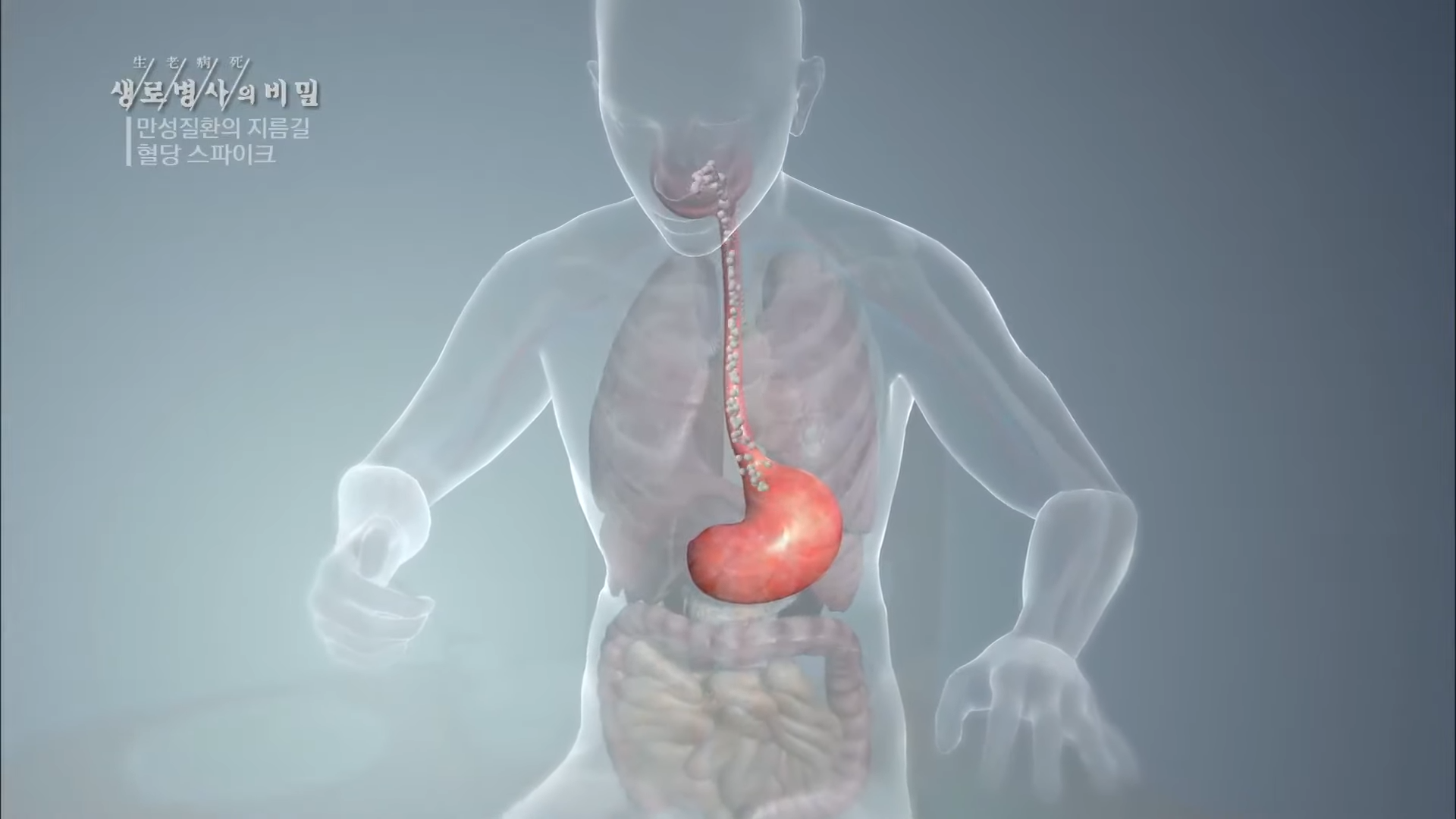 생로병사의 비밀 만성질환의 비밀 혈당 스파이크 당뇨병