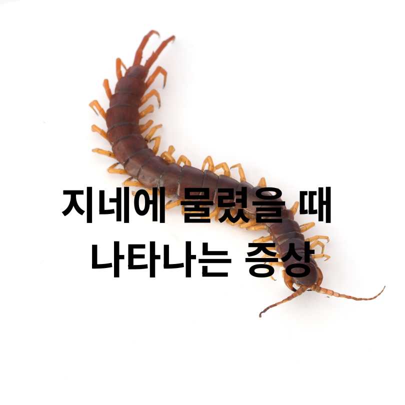 지네에 물리면 증상부터 치료까지, 꼭 알아야 할 응급 대처법