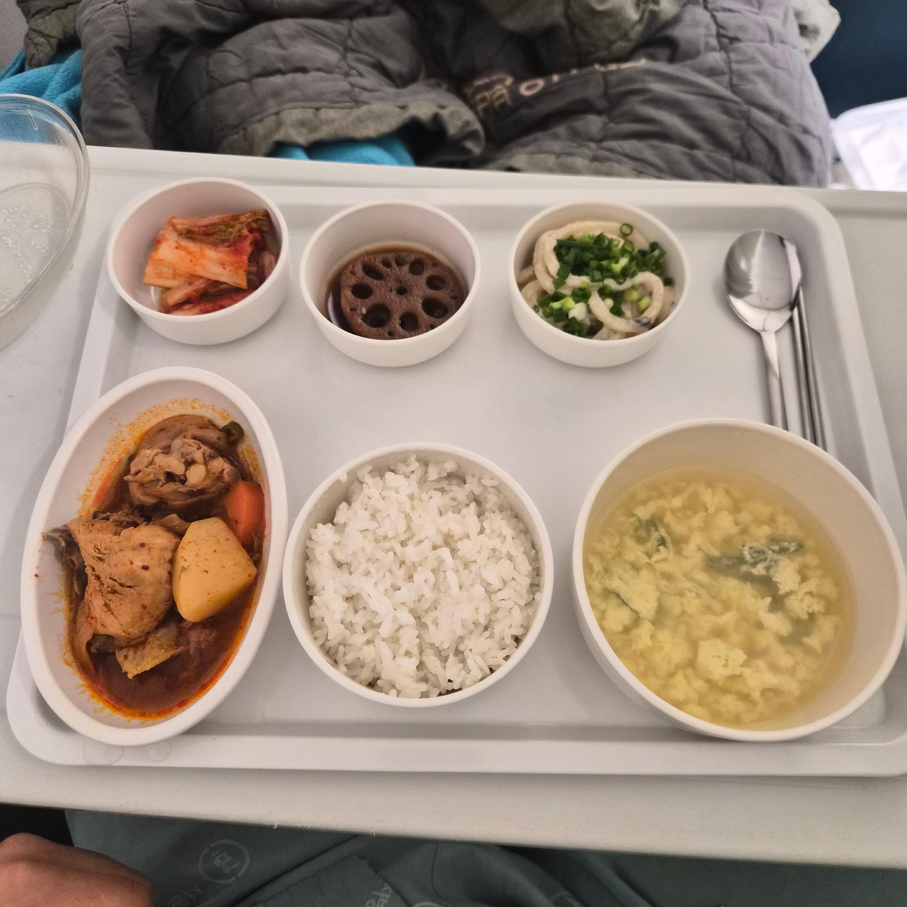어깨 와순파열 봉합수술 후 mri사진 물리치료 기록