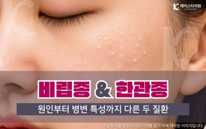 한관종 제거