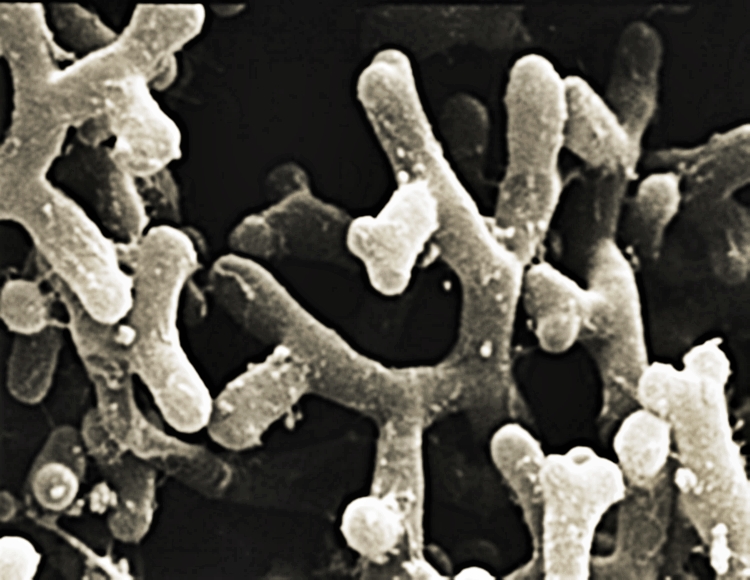나뭇가지처럼 생긴 비피더스균