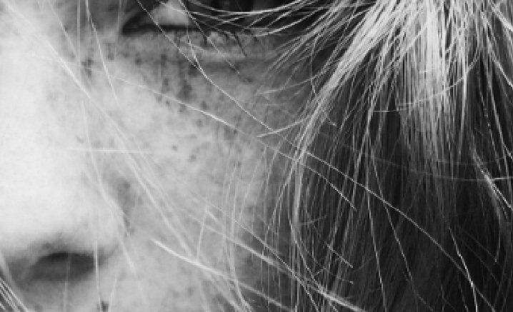 기미가 얼굴에 있는 모습