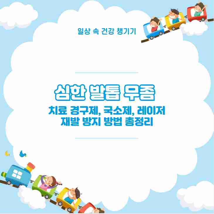 심한 발톱 무좀 치료 경구제, 국소제, 레이저 재발 방지 방법 총정리