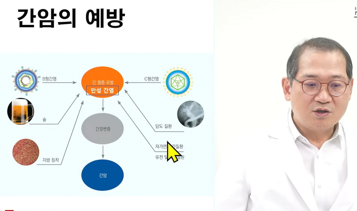 간암의예방