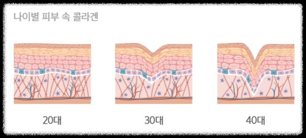 콜라겐과 치매: 두 가지의 숨겨진 연관성
