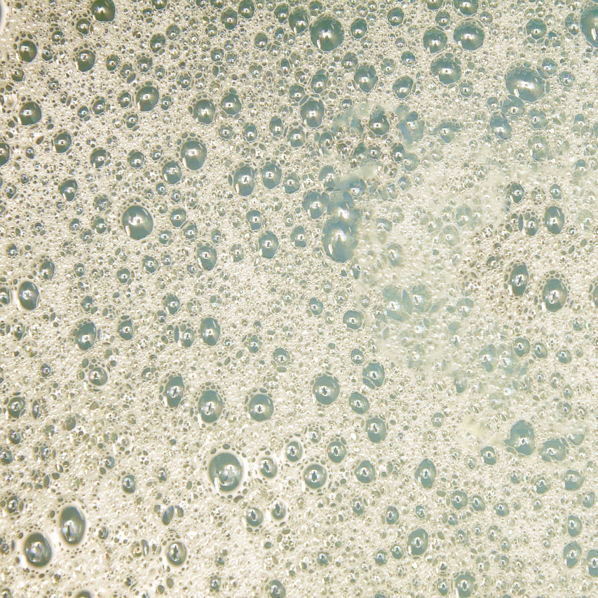 소변에 거품이 많아요