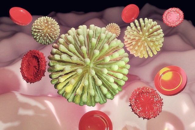 신라젠 주가분석