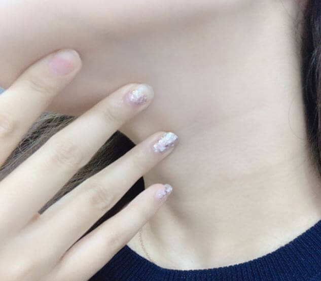 깨끗한 피부