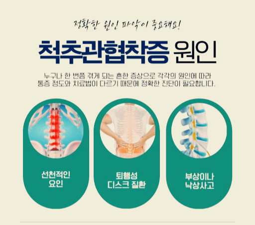 척추협착증의 원인과 증상