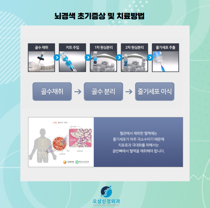 뇌경색 초기증상 3가지 및 치료방법