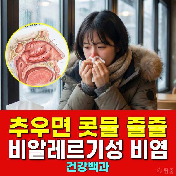 비알레르기 비염 원인