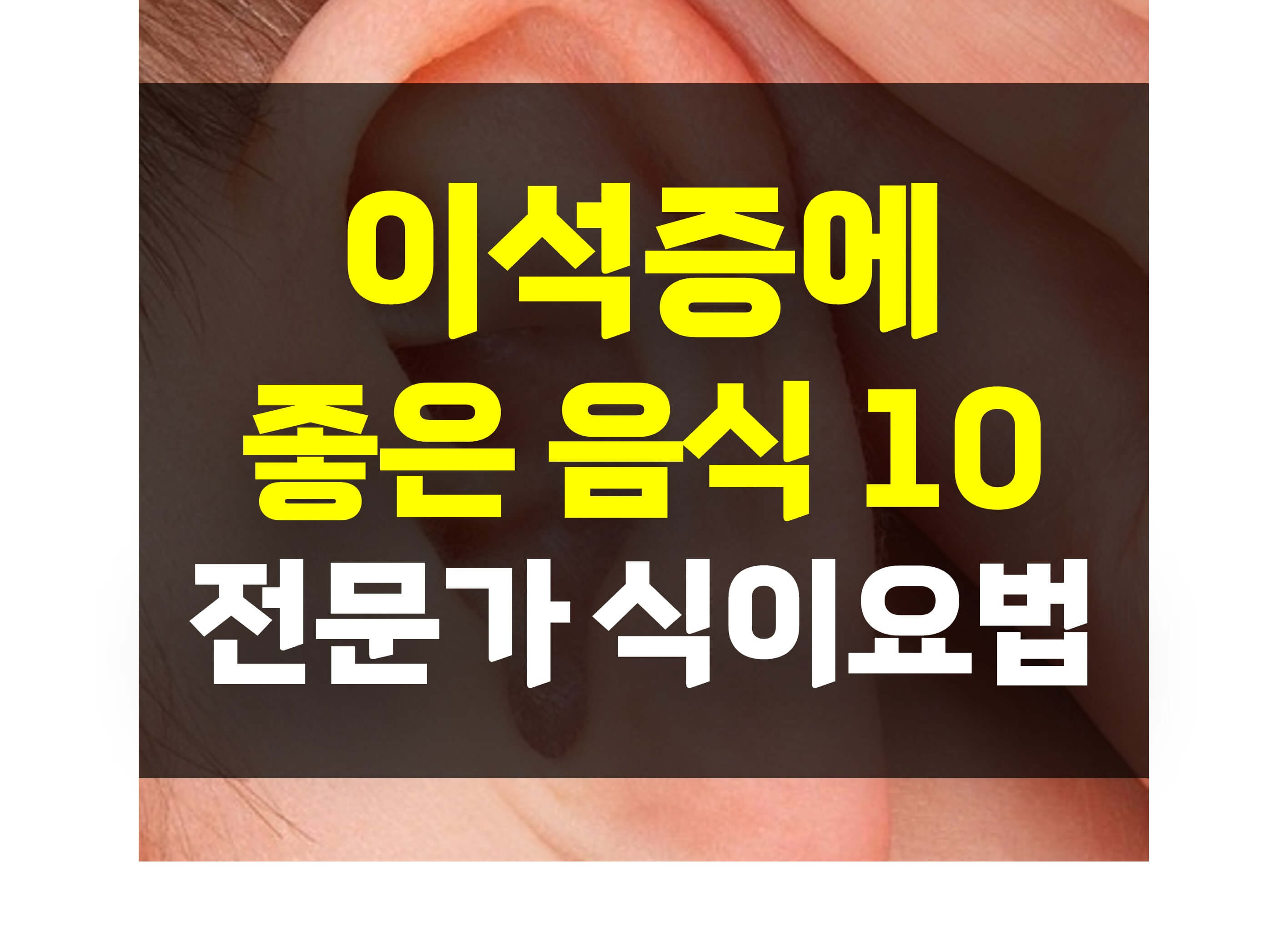 이석증에 좋은 음식