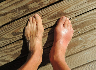 맨발 걷기 부작용