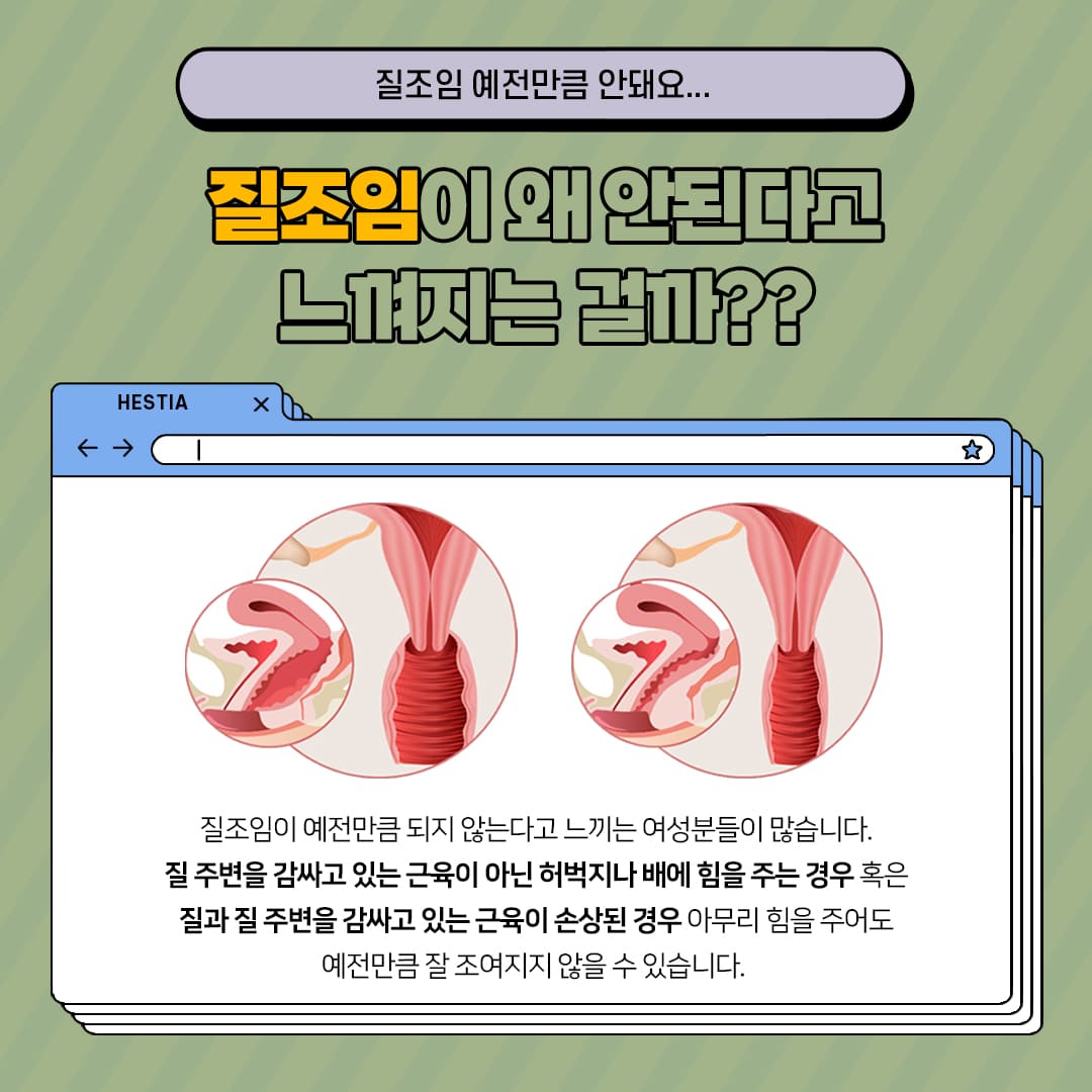 질조임 예전만큼 안돼요.