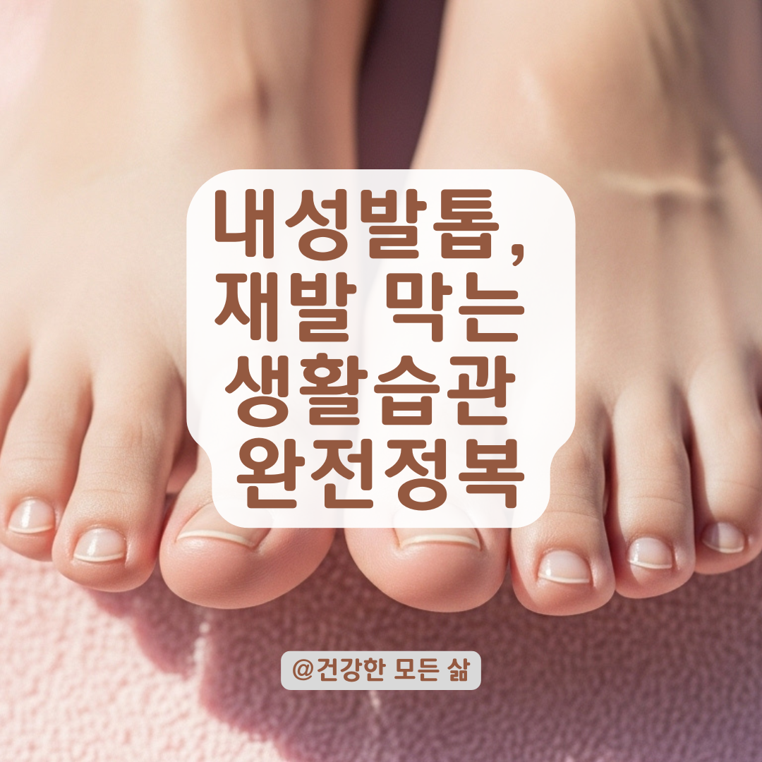 내성발톱, 뽑았는데 왜 또 생길까? 재발을 부르는 생활습관과 대처법 정리.