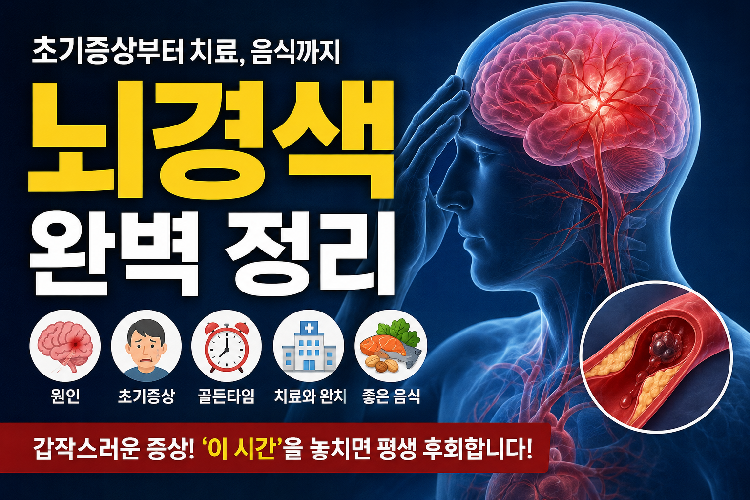 뇌경색의 완벽정리