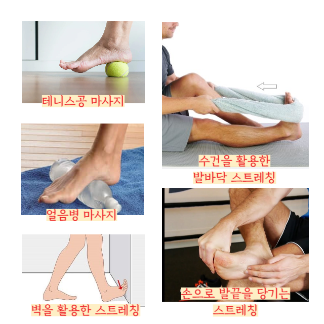 족저근막염-치료법