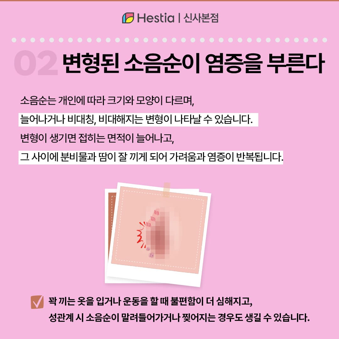 변형된 소음순이 염증을 부른다