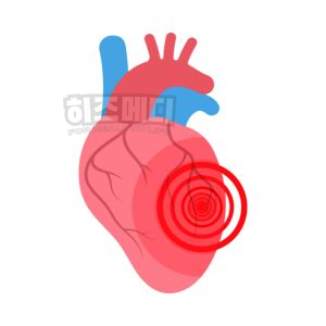 마이코플라스마 폐렴 치료 등교