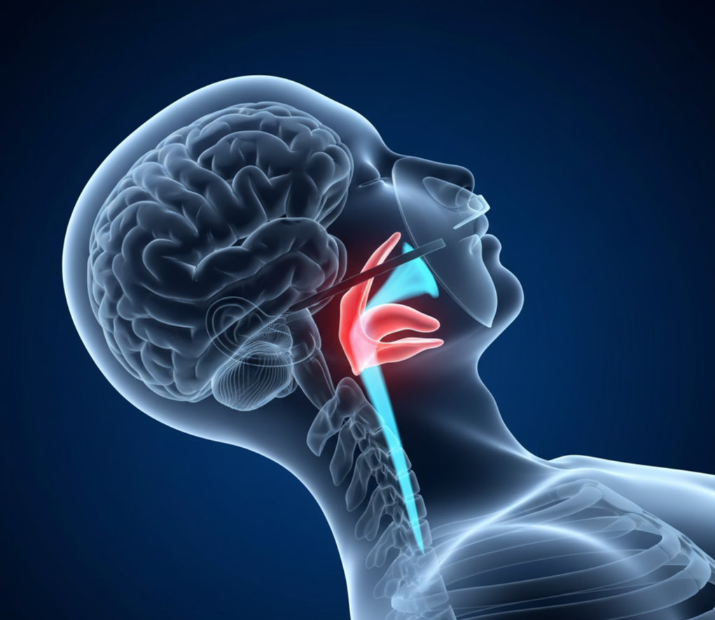 폐쇄성수면무호흡증