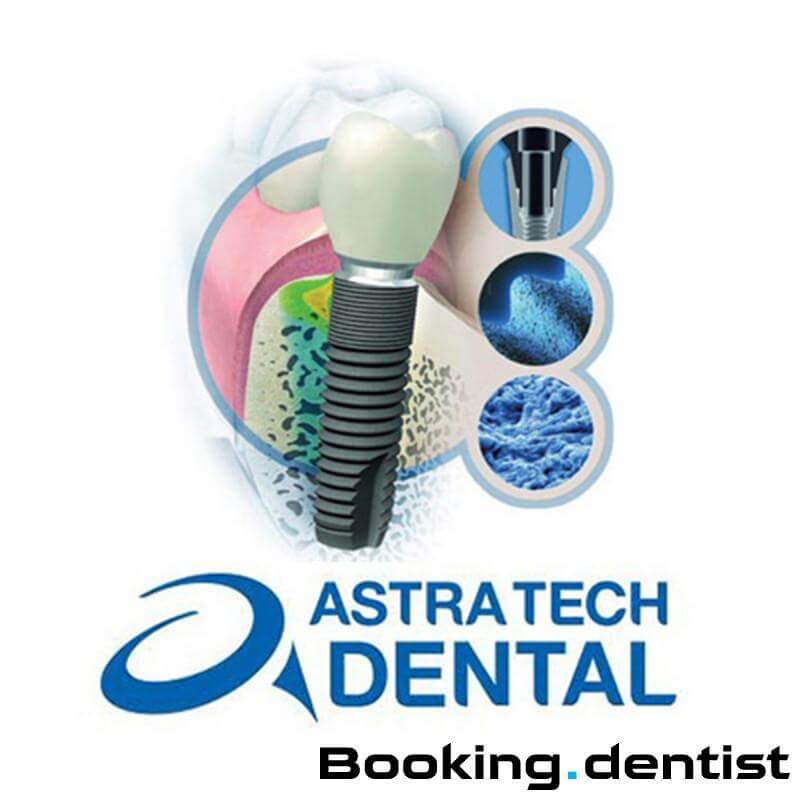 임플란트 가격 차이나는 이유, 아스트라