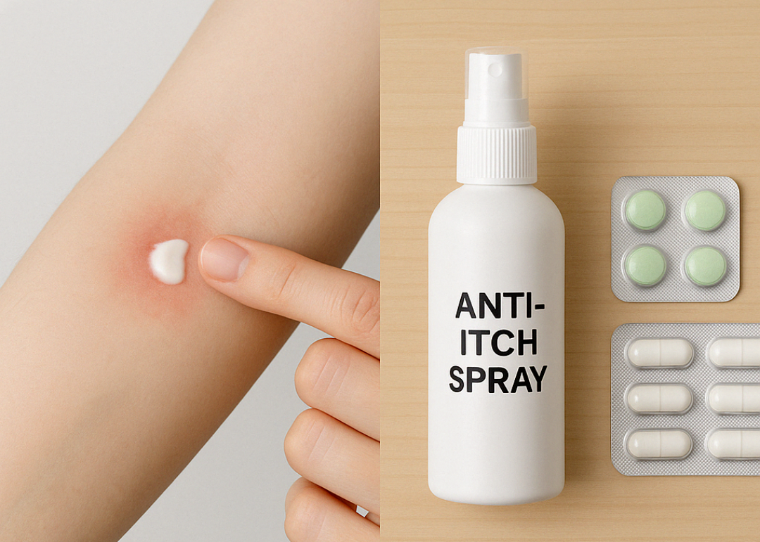 모기 물린 피부에 연고를 바르는 장면과 항히스타민제 성분이 포함된 스프레이 및 약품 이미지, 벌레 대처법 안내용
