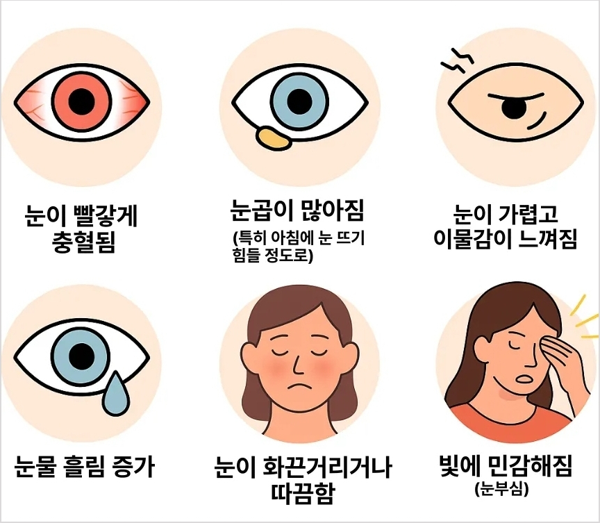 결막염 증상