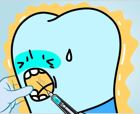 치과 마취주사 부작용, 신경손상 증세, 구강내과 치과의사가 다 알려드림