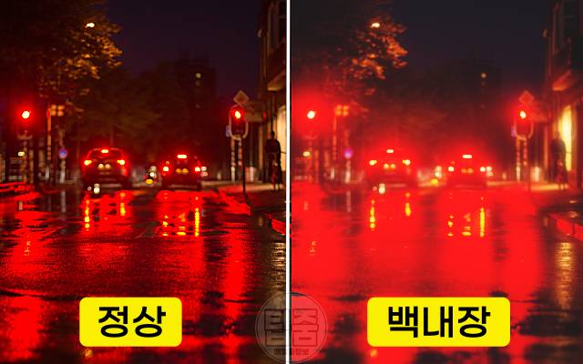 실명 전조증상 백내장