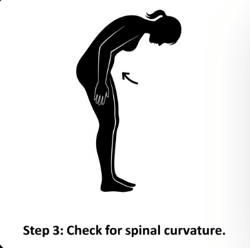 척추 측만증 검사 방법과 병원 선택4