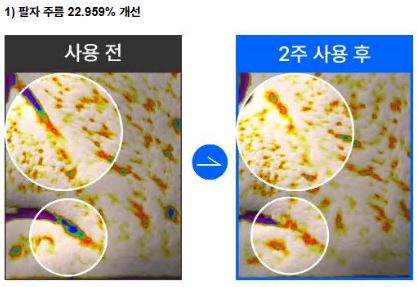 호주-주름-크림-후기