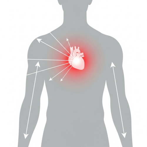 심근경색 전조증상