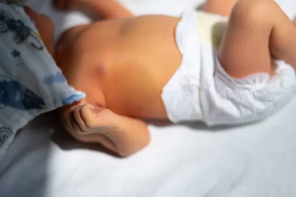 신생아 황달 발생 원인과 증상&amp;#44; 치료 방법&amp;#44; 대처 등 총정리