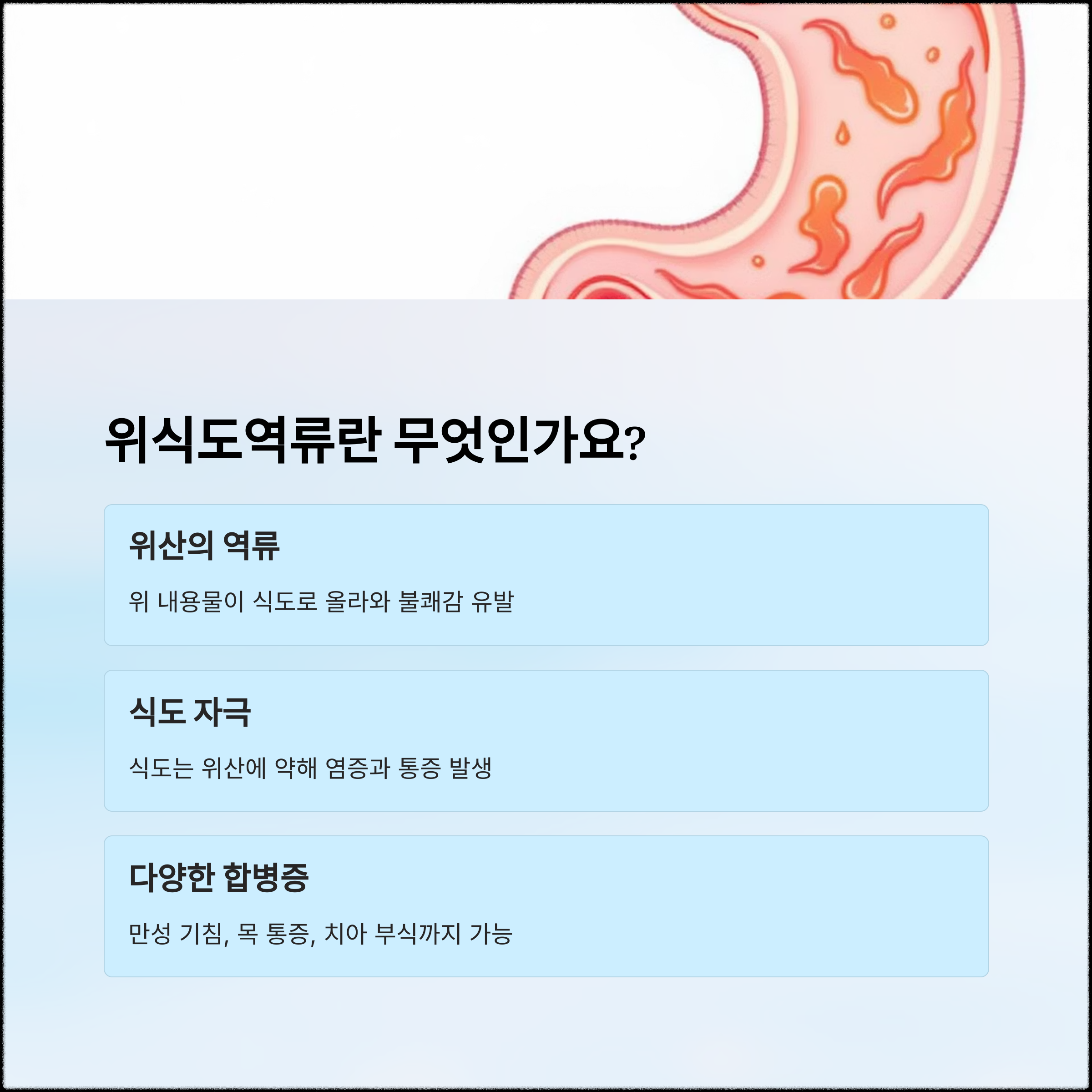 가슴 통증과 만성 기침? 위식도역류 초기 신호일 수 있어요