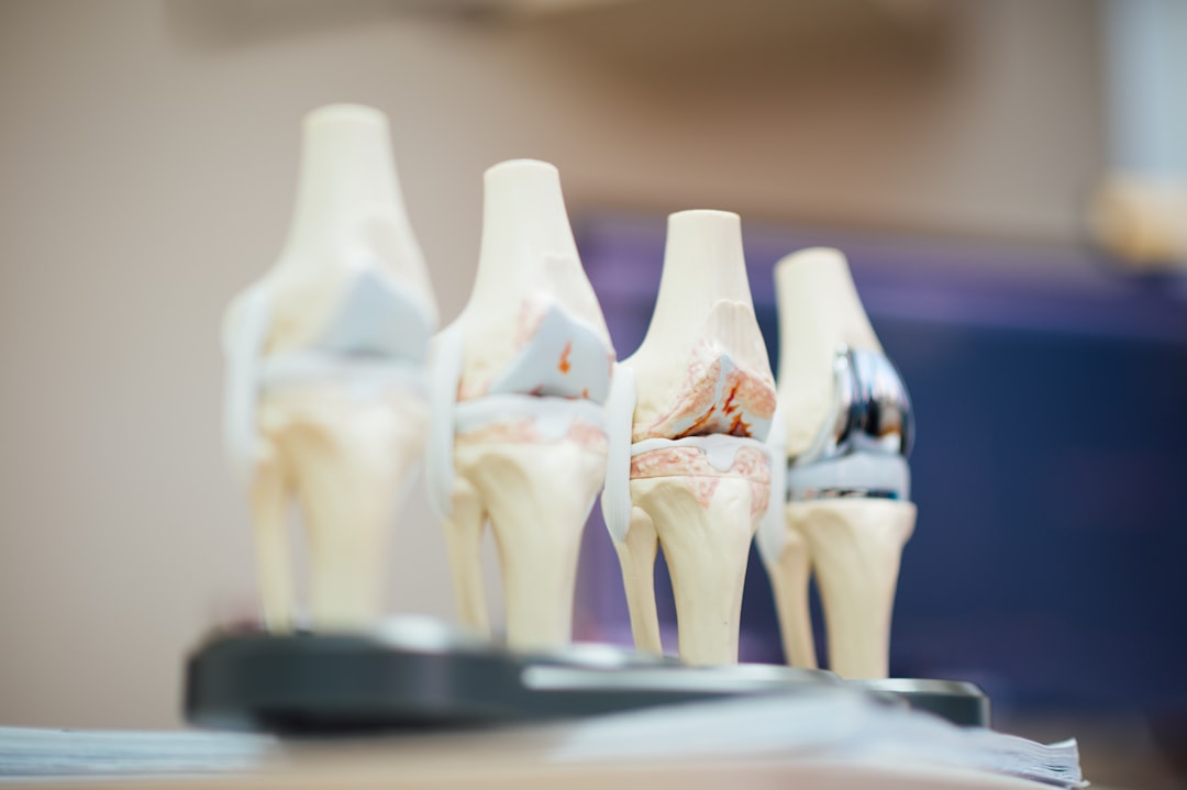 Orthopedics