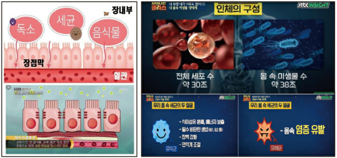 장에 발생되는 질환의 메카니즘