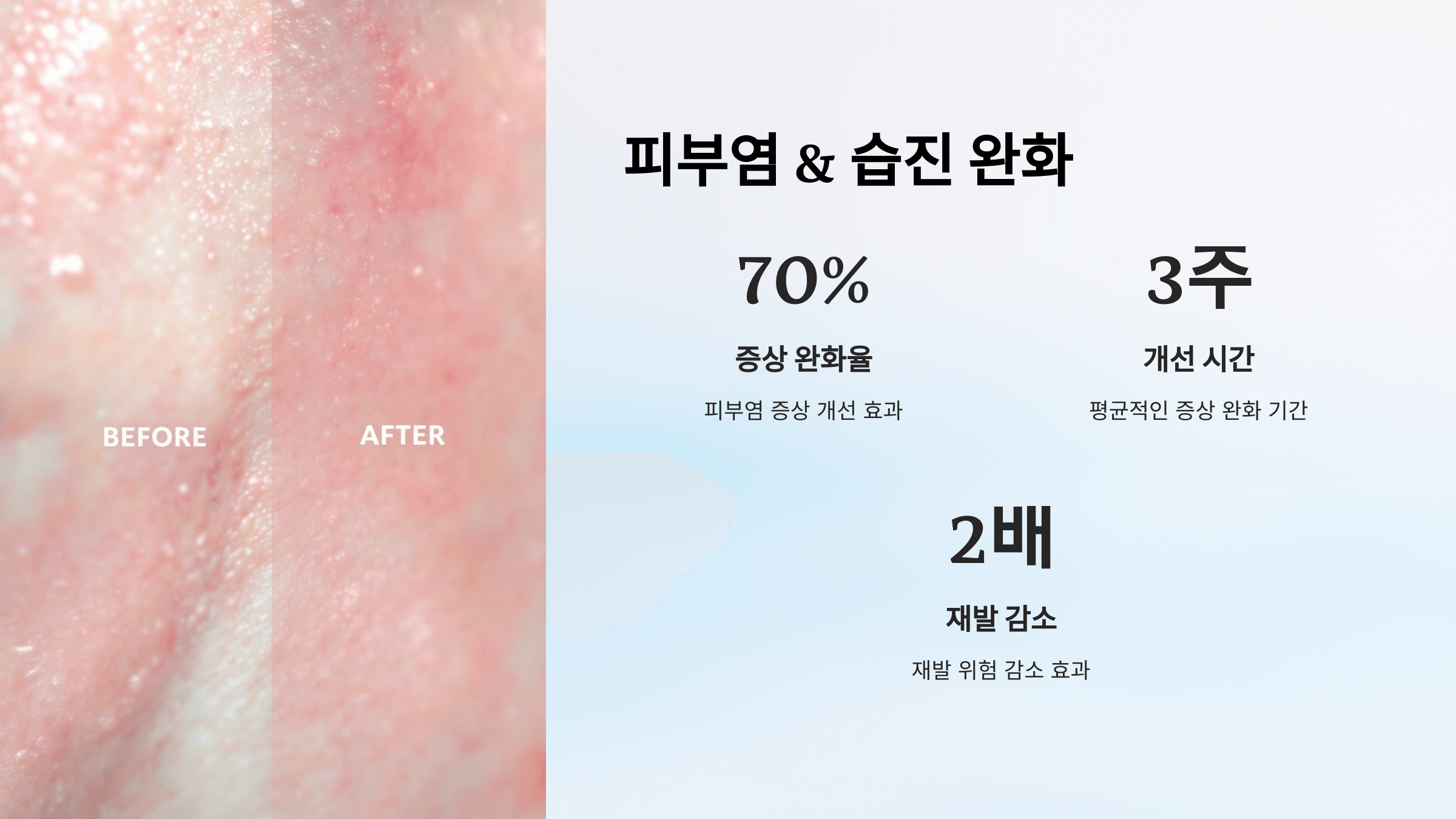 비오틴과 관련된 사진입니다.