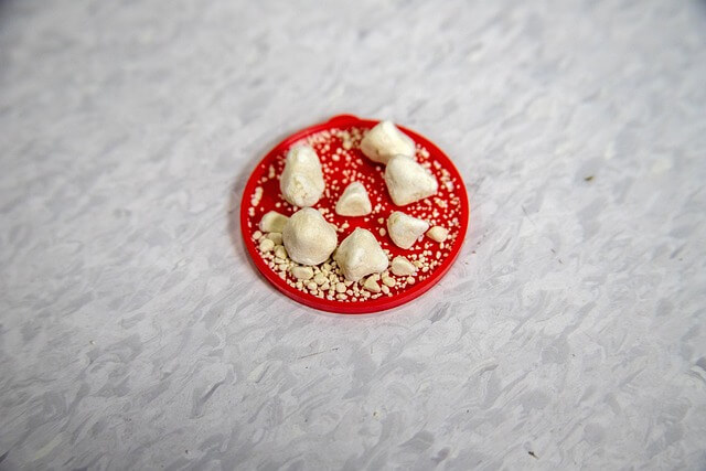 요로결석-결석사진