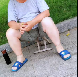 고추털 가려움에 지스톤 크림 바르니까 금방 나아지더라