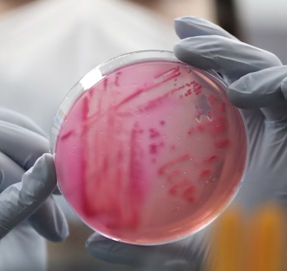 전북 남원 식중독 집단 급식 1000명