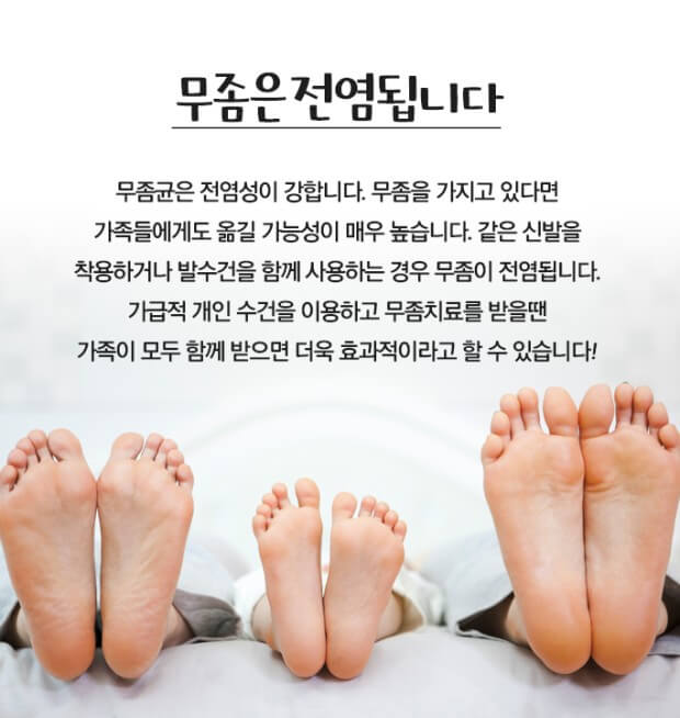 전염성 강한 무좀