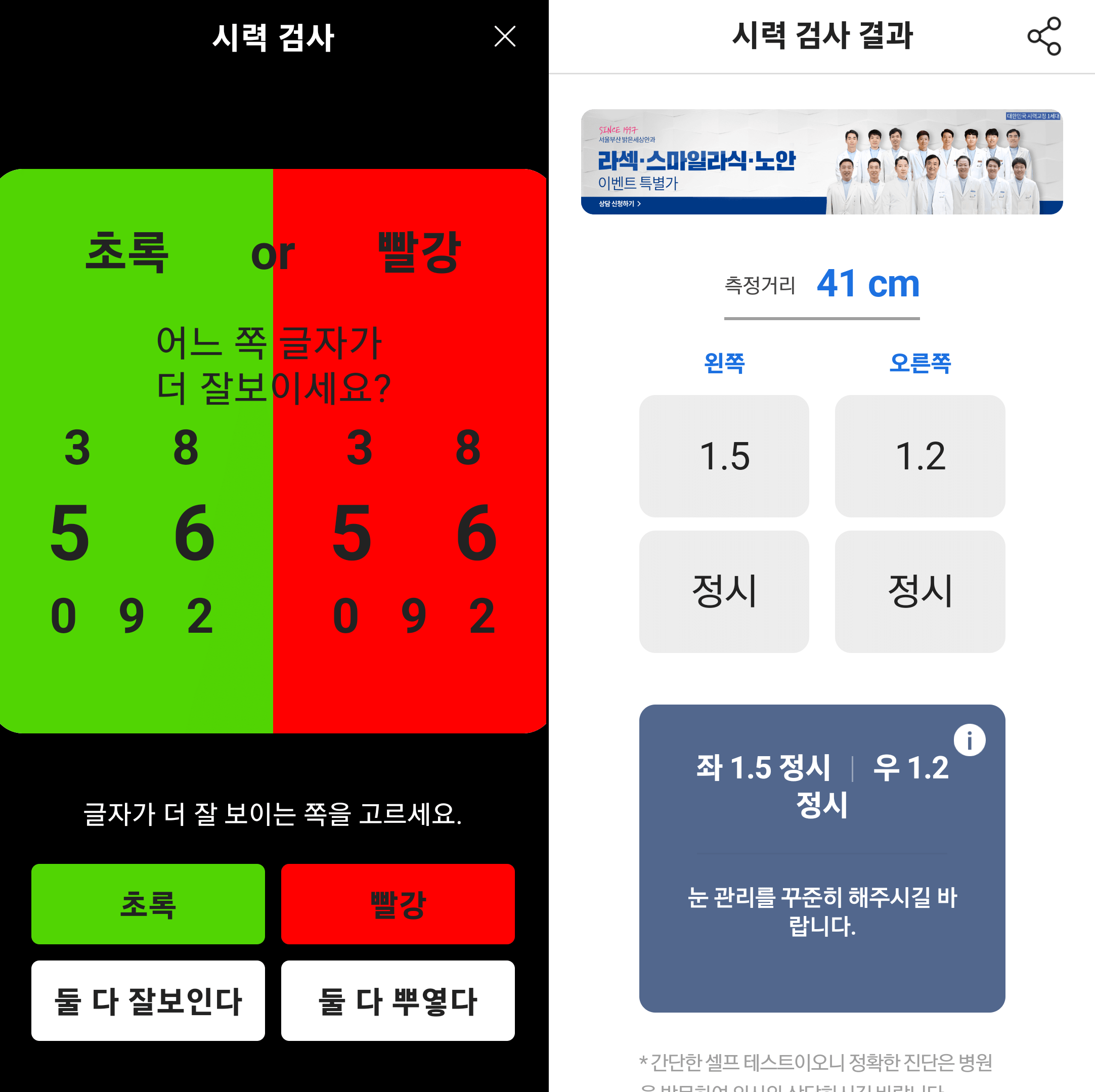 시력 검사 결과