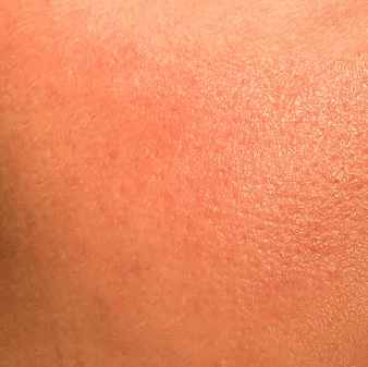 피부 탄력 관리 방법 - 피부 탄력에 좋은 음식