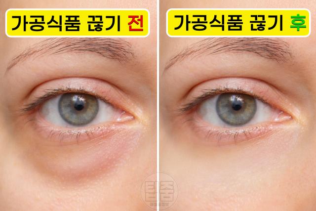 가공식품 끊기 붓기