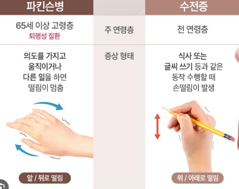파킨슨병 초기증상