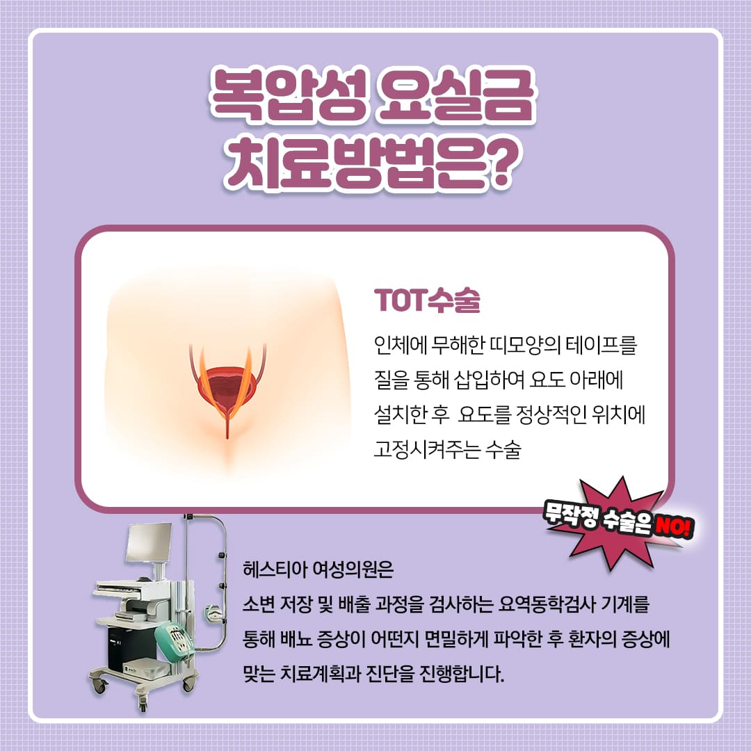복압성 요실금 수술 방법은?