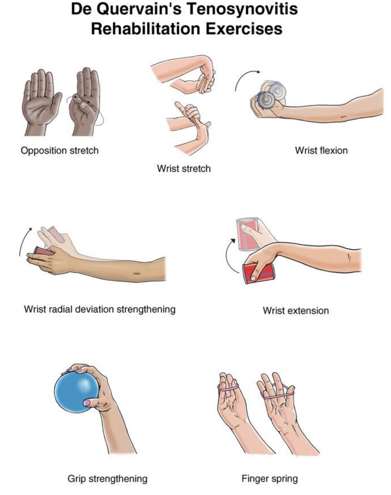 Dequervain-rehabilitation-디퀘르뱅재활