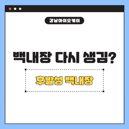 백내장-다시-생김